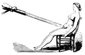 Illustration einer „Hysterie-Therapie“ bei Frauen – ein Paradebeispiel für verrückte Fakten aus der Menschheitsgeschichte